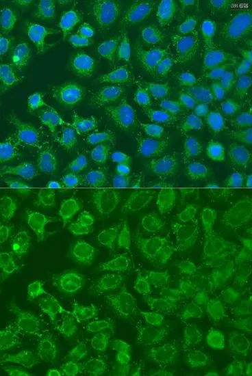 ICC/IF analysis of U2OS cells using GTX33172 EIF2B1 antibody. Blue : DAPI Dilution : 1:100