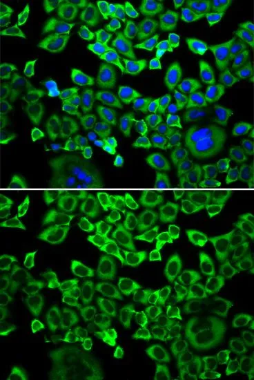 ICC/IF analysis of A549 cells using GTX33175 eIF4B antibody. Blue : DAPI