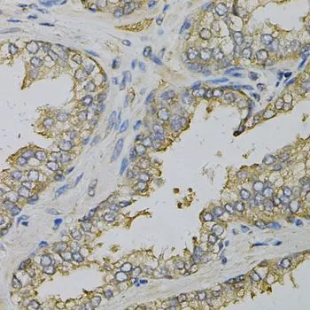 IHC-P analysis of human prostate tissue using GTX33175 eIF4B antibody. Dilution : 1:100