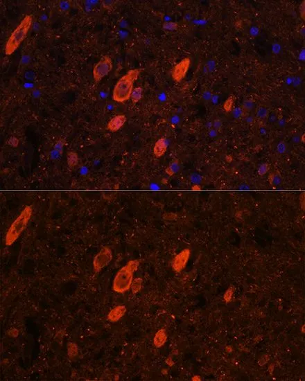 IHC-P analysis of rat brain tissue using GTX33177 HuC antibody. Blue : DAPI Dilution : 1:100