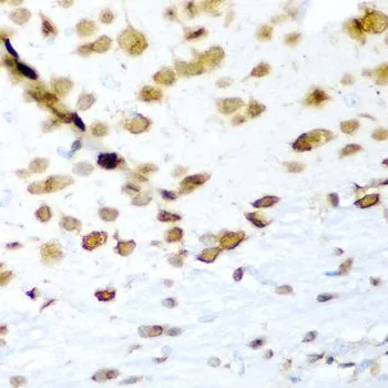 IHC-P analysis of mouse brain tissue using GTX33177 HuC antibody. Dilution : 1:200