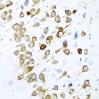 IHC-P analysis of rat brain tissue using GTX33177 HuC antibody. Dilution : 1:200