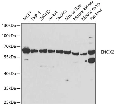WB analysis of various sample lysates using GTX33180 ENOX2 antibody. Dilution : 1:1000 Loading : 25microg per lane WB analysis of various sample lysates using GTX33180 ENOX2 antibody. Dilution : 1:1000 Loading : 25microg per lane