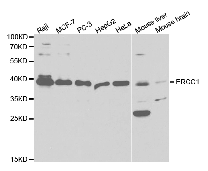 WB analysis of various sample lysates using GTX33185 ERCC1 antibody. Dilution : 1:1000 Loading : 25microg per lane WB analysis of various sample lysates using GTX33185 ERCC1 antibody. Dilution : 1:1000 Loading : 25microg per lane