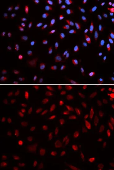 ICC/IF analysis of U2OS cells using GTX33185 ERCC1 antibody. Blue : DAPI