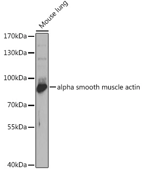 WB analysis of mouse lung tissue lysate using GTX33188 EZH1 antibody. Dilution : 1:1000 Loading : 25microg per lane WB analysis of mouse lung tissue lysate using GTX33188 EZH1 antibody. Dilution : 1:1000 Loading : 25microg per lane