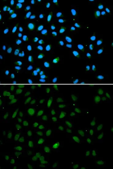 ICC/IF analysis of A549 cells using GTX33188 EZH1 antibody. Blue : DAPI