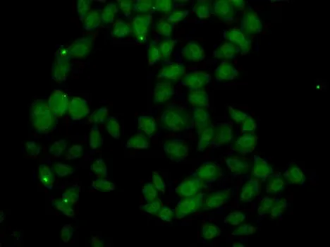 ICC/IF analysis of U2OS cells using GTX33198 FGF14 antibody.