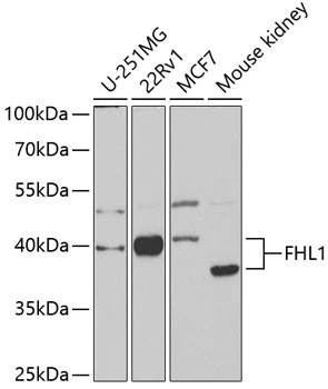 WB analysis of various sample lysates using GTX33199 FHL1 antibody. Dilution : 1:1000 Loading : 25microg per lane WB analysis of various sample lysates using GTX33199 FHL1 antibody. Dilution : 1:1000 Loading : 25microg per lane