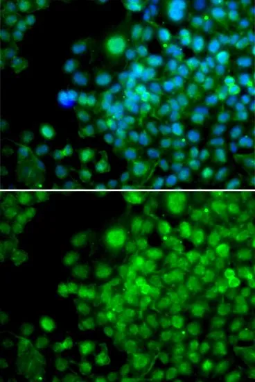 ICC/IF analysis of HeLa cells using GTX33199 FHL1 antibody. Blue : DAPI