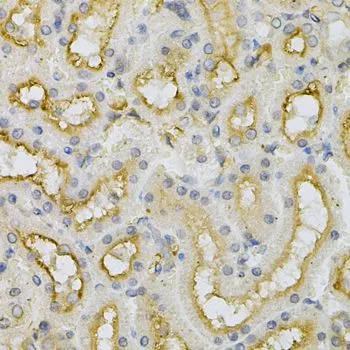 IHC-P analysis of mouse kidney tissue using GTX33199 FHL1 antibody. Dilution : 1:100