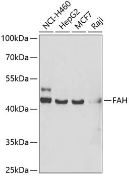 WB analysis of various sample lysates using GTX33205 FAH antibody. Dilution : 1:1000 Loading : 25microg per lane WB analysis of various sample lysates using GTX33205 FAH antibody. Dilution : 1:1000 Loading : 25microg per lane