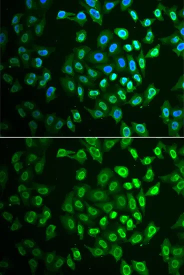 ICC/IF analysis of A549 cells using GTX33205 FAH antibody. Blue : DAPI