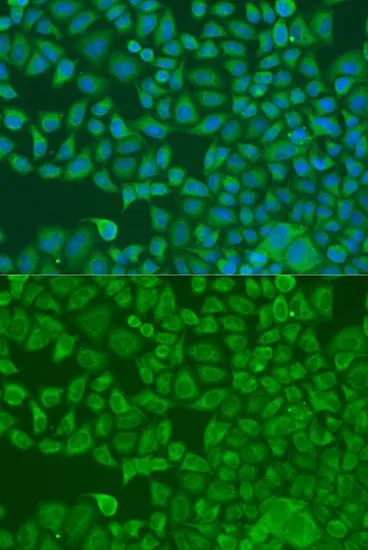 ICC/IF analysis of U2OS cells using GTX33207 FXR2 antibody. Blue : DAPI Dilution : 1:100