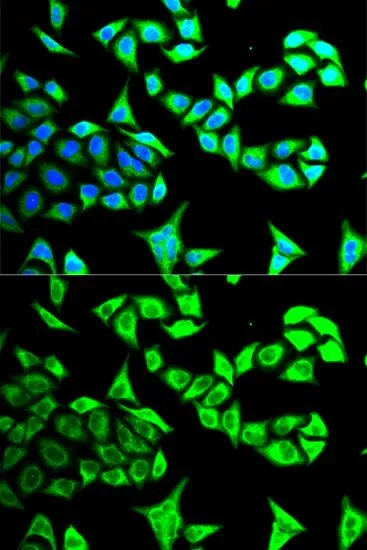 ICC/IF analysis of MCF7 cells using GTX33208 GABARAP antibody. Blue : DAPI