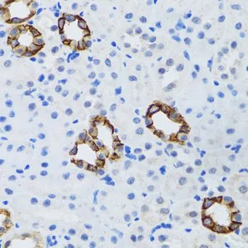 IHC-P analysis of mouse kidney tissue using GTX33208 GABARAP antibody. Dilution : 1:100