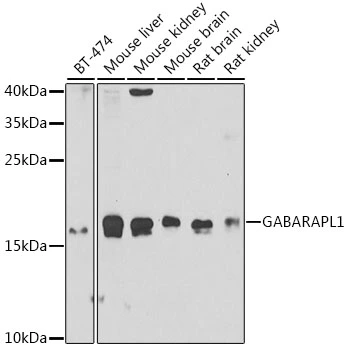 WB analysis of various sample lysates using GTX33209 GABARAPL1 antibody. Dilution : 1:1000 Loading : 25microg per lane WB analysis of various sample lysates using GTX33209 GABARAPL1 antibody. Dilution : 1:1000 Loading : 25microg per lane