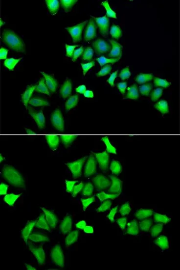 ICC/IF analysis of A549 cells using GTX33212 GALE antibody. Blue : DAPI