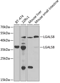 WB analysis of various sample lysates using GTX33214 Galectin 8 antibody. Dilution : 1:1000 Loading : 25microg per lane WB analysis of various sample lysates using GTX33214 Galectin 8 antibody. Dilution : 1:1000 Loading : 25microg per lane
