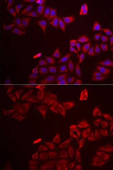 ICC/IF analysis of A549 cells using GTX33214 Galectin 8 antibody. Blue : DAPI
