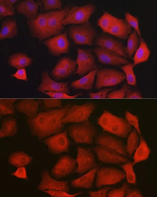 ICC/IF analysis of U2OS cells using GTX33215 GAMT antibody. Blue : DAPI
