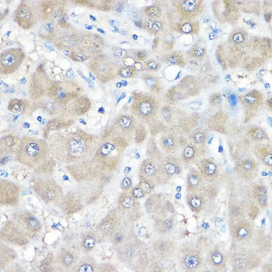 IHC-P analysis of human liver tissue using GTX33215 GAMT antibody. Dilution : 1:500