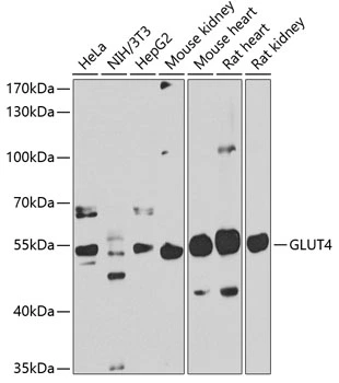 WB analysis of various sample lysates using GTX33221 GLUT4 antibody. Dilution : 1:1000 Loading : 25microg per lane WB analysis of various sample lysates using GTX33221 GLUT4 antibody. Dilution : 1:1000 Loading : 25microg per lane