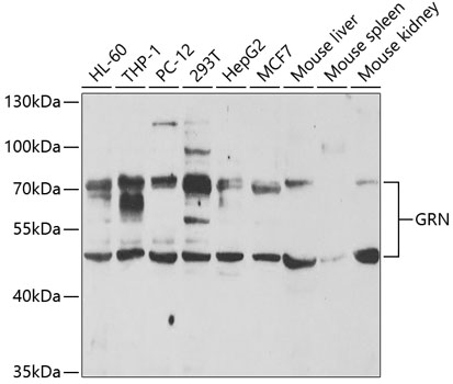 WB analysis of various samples using GTX33228 Granulins antibody. Dilution : 1:1000 Loading : 25ug per lane
