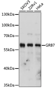 WB analysis of various sample lysates using GTX33229 GRB7 antibody. Dilution : 1:1000 Loading : 25microg per lane WB analysis of various sample lysates using GTX33229 GRB7 antibody. Dilution : 1:1000 Loading : 25microg per lane