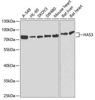 WB analysis of various sample lysates using GTX33235 HAS3 antibody. Dilution : 1:1000 Loading : 25microg per lane WB analysis of various sample lysates using GTX33235 HAS3 antibody. Dilution : 1:1000 Loading : 25microg per lane