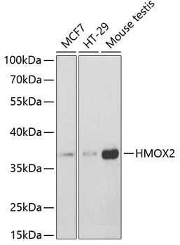 WB analysis of various sample lysates using GTX33238 Heme Oxygenase 2 antibody. Dilution : 1:400 Loading : 25microg per lane WB analysis of various sample lysates using GTX33238 Heme Oxygenase 2 antibody. Dilution : 1:400 Loading : 25microg per lane