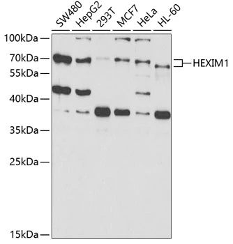 WB analysis of various sample lysates using GTX33240 HEXIM1 antibody. The signal was developed with ECL plus-Enhanced. Dilution : 1:1000 Loading : 25microg per lane WB analysis of various sample lysates using GTX33240 HEXIM1 antibody. The signal was developed with ECL plus-Enhanced. Dilution : 1:1000 Loading : 25microg per lane