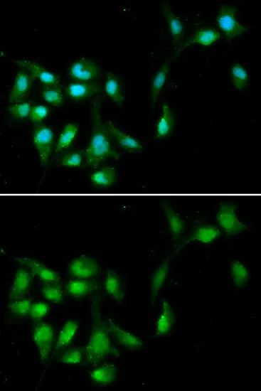 ICC/IF analysis of A549 cells using GTX33240 HEXIM1 antibody. Blue : DAPI