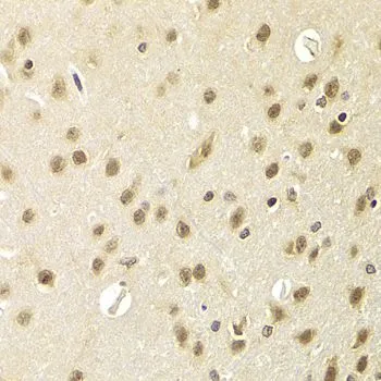 IHC-P analysis of rat brain tissue using GTX33240 HEXIM1 antibody. Dilution : 1:100