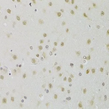 IHC-P analysis of rat brain tissue using GTX33240 HEXIM1 antibody. Dilution : 1:100