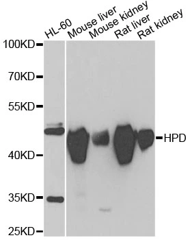 WB analysis of various sample lysates using GTX33247 HPD antibody. The signal was developed with ECL plus-Enhanced. Dilution : 1:1000 Loading : 25microg per lane WB analysis of various sample lysates using GTX33247 HPD antibody. The signal was developed with ECL plus-Enhanced. Dilution : 1:1000 Loading : 25microg per lane