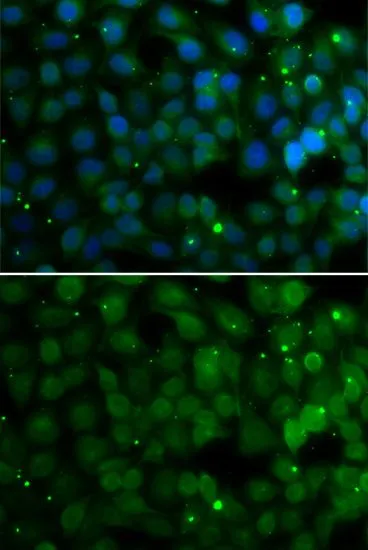 ICC/IF analysis of U2OS cells using GTX33247 HPD antibody. Blue : DAPI