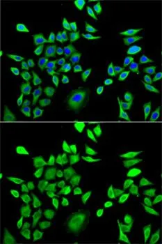 ICC/IF analysis of U2OS cells using GTX33248 HPRT antibody. Blue : DAPI