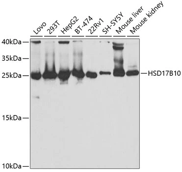 WB analysis of various sample lysates using GTX33249 ERAB antibody. Dilution : 1:1000 Loading : 25microg per lane