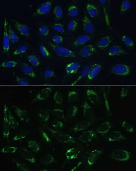 ICC/IF analysis of U2OS cells using GTX33249 ERAB antibody. Blue : DAPI Dilution : 1:100