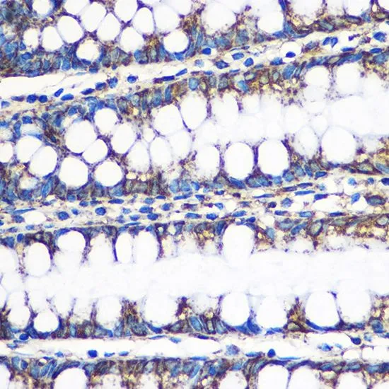 IHC-P analysis of human colon tissue using GTX33249 ERAB antibody. Dilution : 1:100