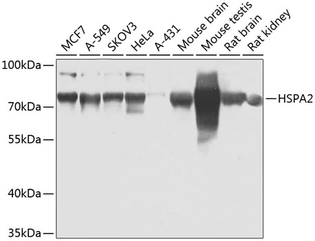WB analysis of various sample lysates using GTX33251 HSPA2 antibody. Dilution : 1:1000 Loading : 25microg per lane WB analysis of various sample lysates using GTX33251 HSPA2 antibody. Dilution : 1:1000 Loading : 25microg per lane
