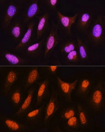 ICC/IF analysis of U2OS cells using GTX33251 HSPA2 antibody. Blue : DAPI Dilution : 1:100