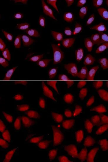 ICC/IF analysis of U2OS cells using GTX33253 HURP antibody. Blue : DAPI