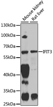 WB analysis of various sample lysates using GTX33255 IFIT3 antibody. The signal was developed with ECL plus-Enhanced. Dilution : 1:1000 Loading : 25microg per lane WB analysis of various sample lysates using GTX33255 IFIT3 antibody. The signal was developed with ECL plus-Enhanced. Dilution : 1:1000 Loading : 25microg per lane