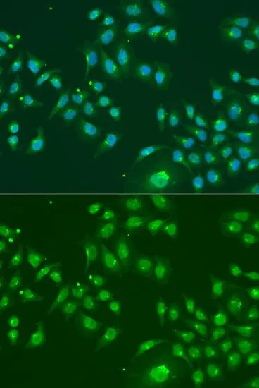 ICC/IF analysis of U2OS cells using GTX33255 IFIT3 antibody. Blue : DAPI Dilution : 1:100