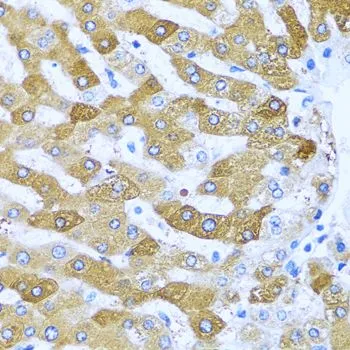 IHC-P analysis of human liver tissue using GTX33255 IFIT3 antibody. Dilution : 1:100