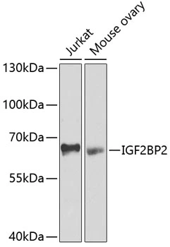 WB analysis of various sample lysates using GTX33256 IGF2BP2 antibody. Dilution : 1:1000 Loading : 25microg per lane WB analysis of various sample lysates using GTX33256 IGF2BP2 antibody. Dilution : 1:1000 Loading : 25microg per lane
