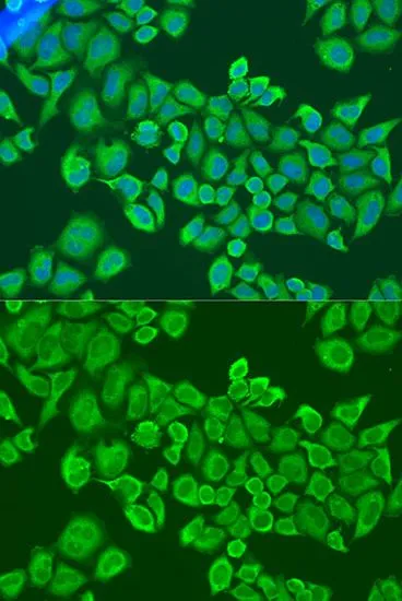 ICC/IF analysis of U2OS cells using GTX33256 IGF2BP2 antibody. Blue : DAPI Dilution : 1:100