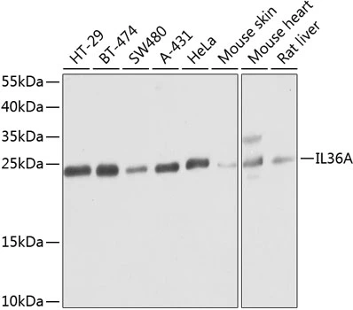 WB analysis of various sample lysates using GTX33260 IL1F6 antibody. Dilution : 1:1000 Loading : 25microg per lane WB analysis of various sample lysates using GTX33260 IL1F6 antibody. Dilution : 1:1000 Loading : 25microg per lane